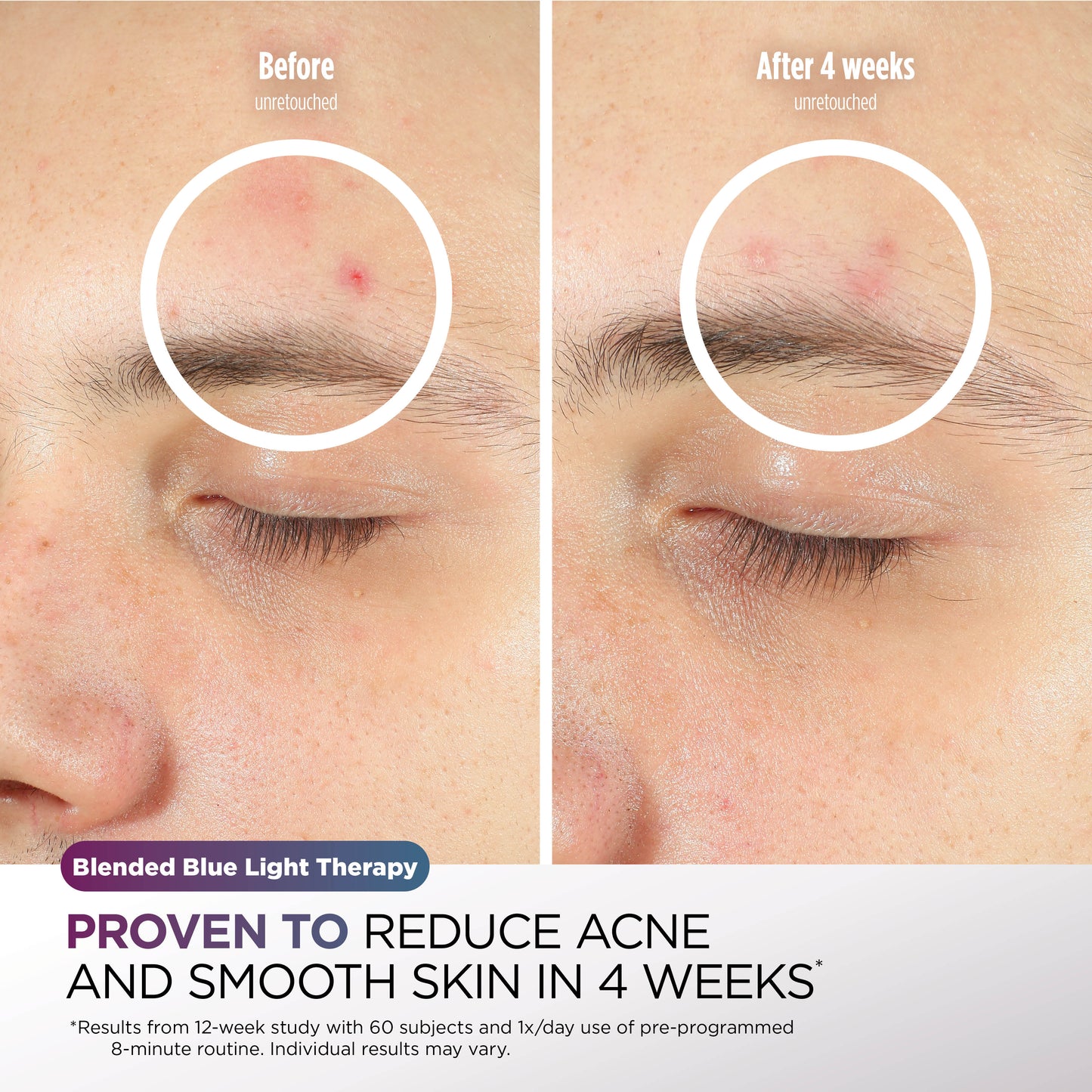 Shark CryoGlow Under-Eye Cooling + LED Mask - Lilac Chill - FW312IEPL