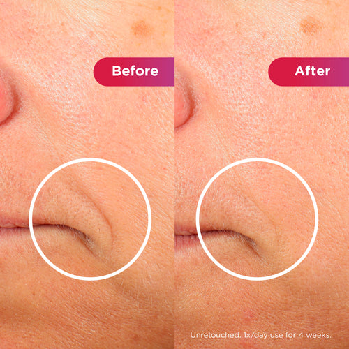 Image of LED Face Mask Before and after results